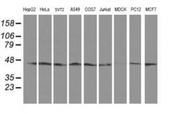 Invitrogen SERPINB13 Monoclonal Antibody (OTI1A7) 100 &mu;L; Unconjugated:Antibodies,