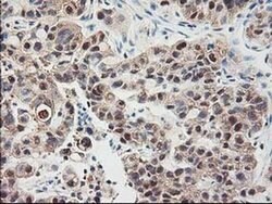 Invitrogen ALS2CR1 Monoclonal Antibody (OTI5A8) 100 &mu;L; Unconjugated:Antibodies,