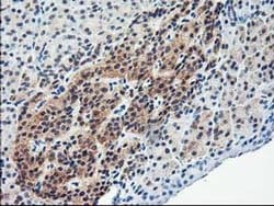 Invitrogen ALS2CR1 Monoclonal Antibody (OTI5A8) 100 &mu;L; Unconjugated:Antibodies,