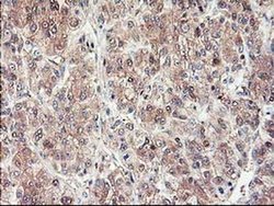 Invitrogen ALS2CR1 Monoclonal Antibody (OTI5A8) 100 &mu;L; Unconjugated:Antibodies,