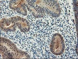 Invitrogen ALS2CR1 Monoclonal Antibody (OTI5A8) 100 &mu;L; Unconjugated:Antibodies,