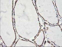 Invitrogen ALS2CR1 Monoclonal Antibody (OTI5A8) 100 &mu;L; Unconjugated:Antibodies,