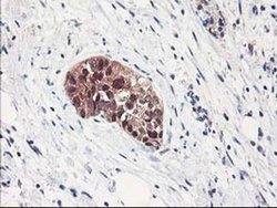 Invitrogen ALS2CR1 Monoclonal Antibody (OTI5A8) 100 &mu;L; Unconjugated:Antibodies,