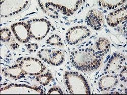 Invitrogen TBC1D21 Monoclonal Antibody (OTI1C7) 100 &mu;L; Unconjugated:Antibodies,
