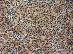 Invitrogen TBC1D21 Monoclonal Antibody (OTI1C7) 100 &mu;L; Unconjugated:Antibodies,