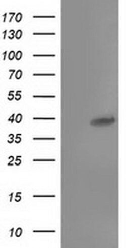 Invitrogen TBC1D21 Monoclonal Antibody (OTI1C7) 100 &mu;L; Unconjugated:Antibodies,