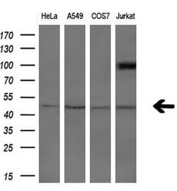 Invitrogen ASCC1 Monoclonal Antibody (OTI6G5) 100 &mu;L; Unconjugated:Antibodies,