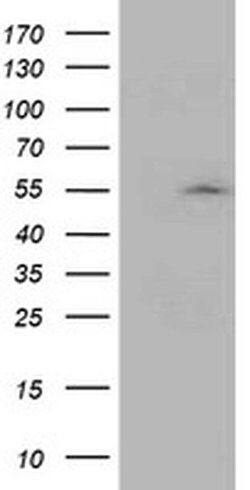Invitrogen ASCC1 Monoclonal Antibody (OTI6G5) 100 &mu;L; Unconjugated:Antibodies,