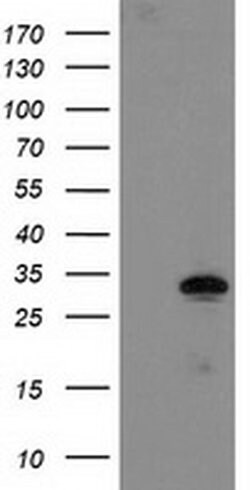 Invitrogen NUBPL Monoclonal Antibody (OTI1C5) 100 &mu;L; Unconjugated:Antibodies,