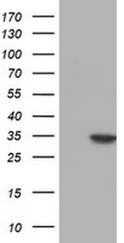 Invitrogen NUBPL Monoclonal Antibody (OTI5D5) 100 &mu;L; Unconjugated:Antibodies,