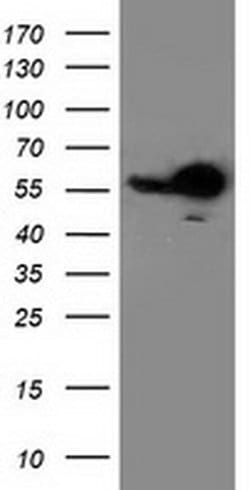 Invitrogen RbAp46 Monoclonal Antibody (OTI4C9) 100 &mu;L; Unconjugated:Antibodies,