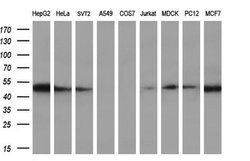 Invitrogen RbAp46 Monoclonal Antibody (OTI4C9) 100 &mu;L; Unconjugated:Antibodies,
