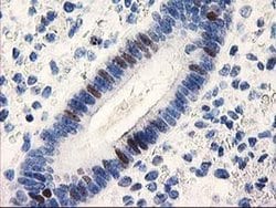 Invitrogen UNG Monoclonal Antibody (OTI1G2) 100 &mu;L; Unconjugated:Antibodies,