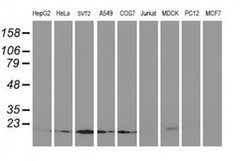 Invitrogen UBE2M Monoclonal Antibody (OTI2D9) 100 &mu;L; Unconjugated:Antibodies,