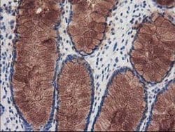 Invitrogen Katanin p80 Monoclonal Antibody (OTI5C4) 100 &mu;L; Unconjugated:Antibodies,