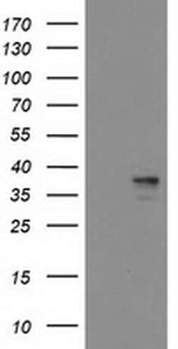 Invitrogen Heme oxygenase 2 Monoclonal Antibody (OTI1D10) 100 &mu;L | Buy Online | Invitrogen&trade; | Fisher Scientific