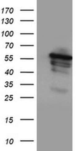 Invitrogen CYP2A6 Monoclonal Antibody (OTI2A8) 100 &mu;L; Unconjugated:Antibodies,