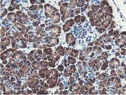 Invitrogen NUDT18 Monoclonal Antibody (OTI1A5) 100 &mu;L; Unconjugated:Antibodies,