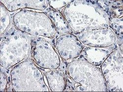Invitrogen LDLRAP1 Monoclonal Antibody (OTI4B10) 100 &mu;L; Unconjugated:Antibodies,