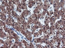Invitrogen CYP2A6 Monoclonal Antibody (OTI1D2) 100 &mu;L | Buy Online | Invitrogen&trade; | Fisher Scientific