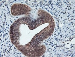 Invitrogen CYP2A6 Monoclonal Antibody (OTI1D2) 100 &mu;L | Buy Online | Invitrogen&trade; | Fisher Scientific