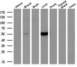 Invitrogen CYP2A6 Monoclonal Antibody (OTI1D2) 100 &mu;L | Buy Online | Invitrogen&trade; | Fisher Scientific