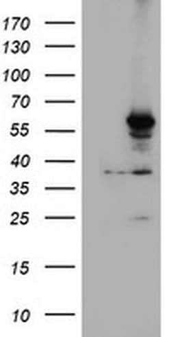 Invitrogen CYP2A6 Monoclonal Antibody (OTI1D2) 100 &mu;L | Buy Online | Invitrogen&trade; | Fisher Scientific