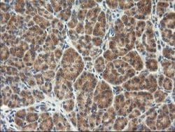 Invitrogen TRK fused gene Monoclonal Antibody (OTI2C3) 100 &mu;L; Unconjugated:Antibodies,