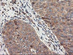 Invitrogen TRK fused gene Monoclonal Antibody (OTI2C3) 100 &mu;L; Unconjugated:Antibodies,