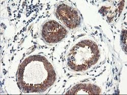 Invitrogen TRK fused gene Monoclonal Antibody (OTI2C3) 100 &mu;L; Unconjugated:Antibodies,