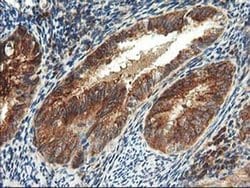 Invitrogen TRK fused gene Monoclonal Antibody (OTI2C3) 100 &mu;L; Unconjugated:Antibodies,