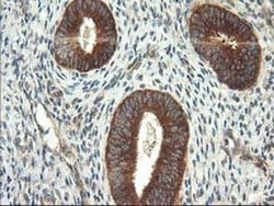 Invitrogen TRK fused gene Monoclonal Antibody (OTI2C3) 100 &mu;L; Unconjugated:Antibodies,