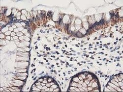 Invitrogen HARS2 Monoclonal Antibody (OTI6F9) 100 &mu;L; Unconjugated:Antibodies,