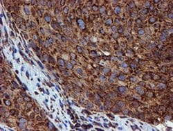 Invitrogen ERP72 Monoclonal Antibody (OTI2C11) 100 &mu;L; Unconjugated:Antibodies,