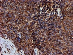 Invitrogen ERP72 Monoclonal Antibody (OTI2C11) 100 &mu;L; Unconjugated:Antibodies,