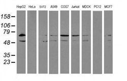 Invitrogen ERP72 Monoclonal Antibody (OTI2E2) 100 &mu;L; Unconjugated:Antibodies,