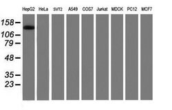 Invitrogen PTK7 Monoclonal Antibody (OTI2E7) 100 &mu;L; Unconjugated:Antibodies,