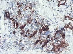 Invitrogen SERPINB2 Monoclonal Antibody (OTI1F6) 100 &mu;L; Unconjugated:Antibodies,