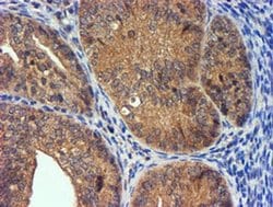 Invitrogen PDSS2 Monoclonal Antibody (OTI1D10) 100 &mu;L; Unconjugated:Antibodies,