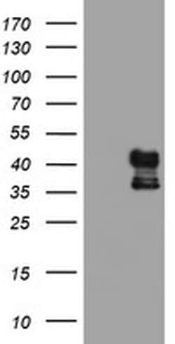 Invitrogen PDSS2 Monoclonal Antibody (OTI1D10) 100 &mu;L; Unconjugated:Antibodies,