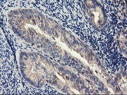 Invitrogen PDSS2 Monoclonal Antibody (OTI2A3) 100 &mu;L; Unconjugated:Antibodies,