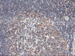 Invitrogen PFKP Monoclonal Antibody (OTI1F2) 100 &mu;L; Unconjugated:Antibodies,