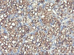 Invitrogen PFKP Monoclonal Antibody (OTI1D6) 100 &mu;L; Unconjugated:Antibodies,