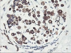 Invitrogen PFKP Monoclonal Antibody (OTI1D6) 100 &mu;L; Unconjugated:Antibodies,