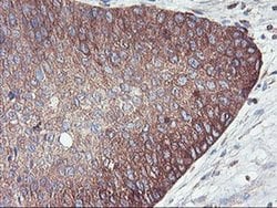 Invitrogen PFKP Monoclonal Antibody (OTI1D6) 100 &mu;L; Unconjugated:Antibodies,