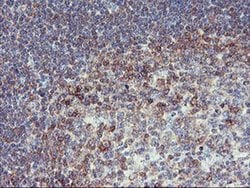 Invitrogen PFKP Monoclonal Antibody (OTI1D6) 100 &mu;L; Unconjugated:Antibodies,