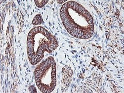 Invitrogen PFKP Monoclonal Antibody (OTI1D6) 100 &mu;L; Unconjugated:Antibodies,