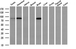 Invitrogen PFKP Monoclonal Antibody (OTI1D6) 100 &mu;L; Unconjugated:Antibodies,
