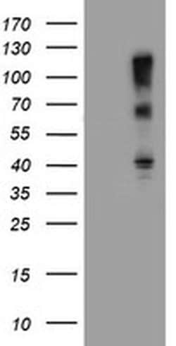 Invitrogen FBXO31 Monoclonal Antibody (OTI1A11) 100 &mu;L; Unconjugated:Antibodies,