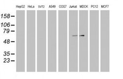 Invitrogen FBXO31 Monoclonal Antibody (OTI1A11) 100 &mu;L; Unconjugated:Antibodies,
